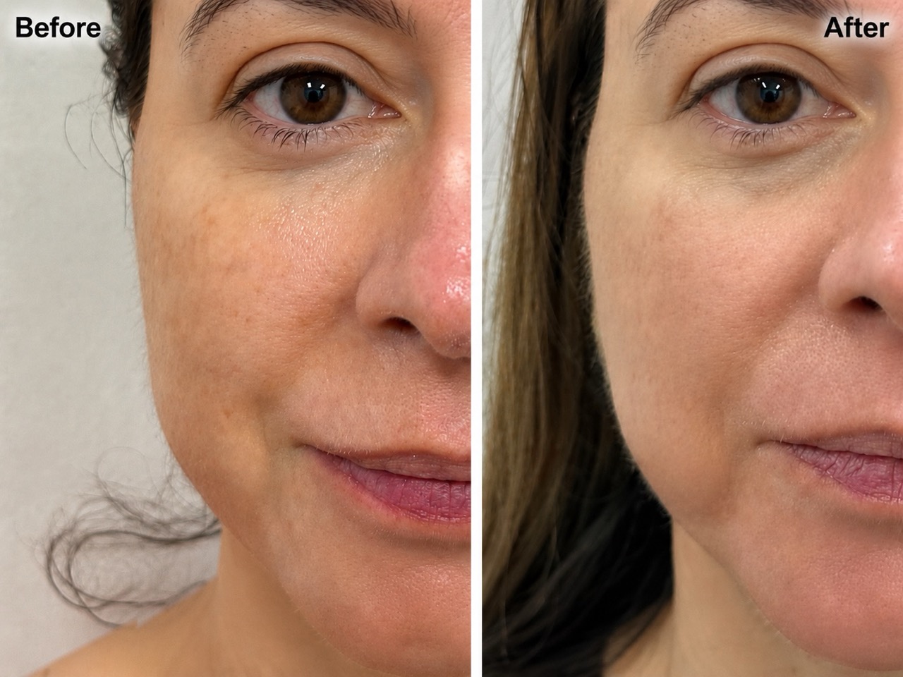 Facial dark spots